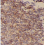 IHC-P analysis of human spleen tissue HLA-DPB1 antibody (1/50 dilution).