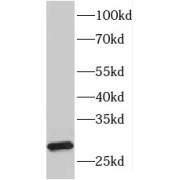 WB analysis of Raji cells, using HLA-DQA2 antibody (1/300 dilution).