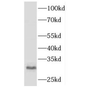 WB analysis of HepG2 cells, using HLA-DRB5 antibody (1/500 dilution).