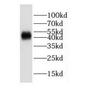 WB analysis of Raji cells, using HLA-F antibody (1/2000 dilution).