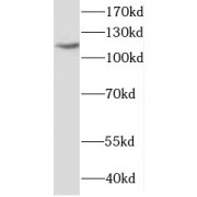 WB analysis of HeLa cells, using HLTF antibody (1/300 dilution).