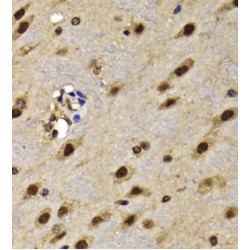 High Mobility Group Protein 20A (HMG20A) Antibody