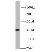 WB analysis of Jurkat cells, using HMG20A antibody (1/1000 dilution).