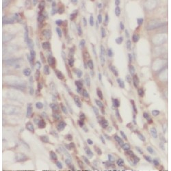 SWI/SNF-Related Matrix-Associated Actin-Dependent Regulator of Chromatin Subfamily E Member 1-Related (HMG20B) Antibody