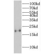 WB analysis of NIH/3T3 cells, using HMGA2 antibody (1/1000 dilution).