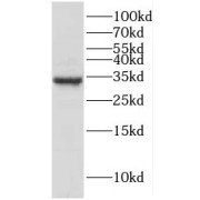 WB analysis of Jurkat cells, using HMGB2 antibody (1/600 dilution).