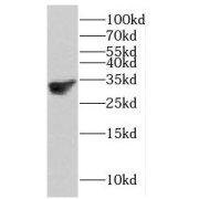 WB analysis of Jurkat cells, using HMGB2 antibody (1/600 dilution).
