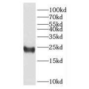 WB analysis of human testis tissue, using HMGB4 antibody (1/300 dilution).