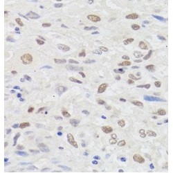 Non-Histone Chromosomal Protein HMG-14 (HMGN1) Antibody