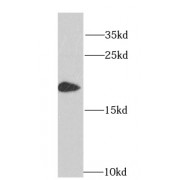 WB analysis of HeLa cells, using HMGN1 antibody (1/1000 dilution).