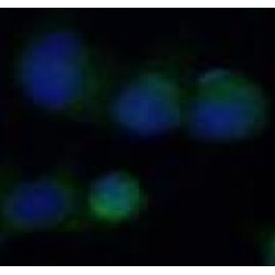 Heme Oxygenase 1 (HMOX1) Antibody