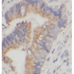 Heme Oxygenase 1 (HMOX1) Antibody