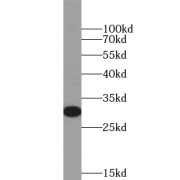 WB analysis of mouse liver tissue, using HMOX1 antibody (1/600 dilution).