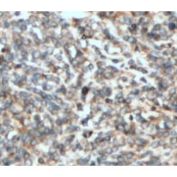 Heme Oxygenase 2 (HMOX2) Antibody