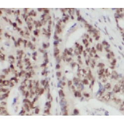 Hepatocyte Nuclear Factor 1-Beta (HNF1B) Antibody