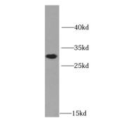 WB analysis of human liver tissue, using HNMT antibody (1/1000 dilution).