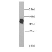 WB analysis of HL-60 cells, using HNRNPA2B1 antibody (1/1000 dilution).