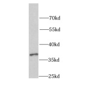 WB analysis of HeLa cells, using hnRNP-E1 antibody (1/500 dilution).