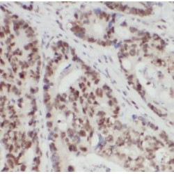 Heterogeneous Nuclear Ribonucleoprotein F (HNRNPF) Antibody