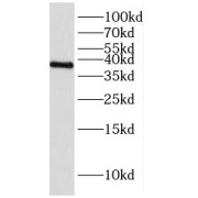 WB analysis of PC-3 cells, using HNRNPH3 antibody (1/300 dilution).