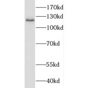 WB analysis of Jurkat cells, using HNRNPU antibody (1/500 dilution).