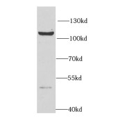 WB analysis of MCF-7 cells, using HNRNPUL2-Specific antibody (1/300 dilution).