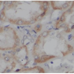 Protein Hook Homolog 3 (HOOK3) Antibody