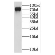 WB analysis of human liver tissue, using HOOK3 antibody (1/500 dilution).