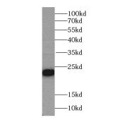 WB analysis of K-562 cells, using PSMC3IP antibody (1/500 dilution).