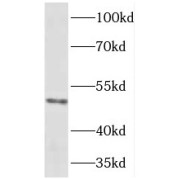 WB analysis of mouse heart tissue, using HOXC10 antibody (1/500 dilution).