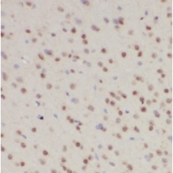 Homeobox Protein Hox-D13 (HOXD13) Antibody