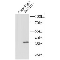 Homeobox Protein Hox-D13 (HOXD13) Antibody