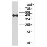 WB analysis of A549 cells, using HOXD13 antibody (1/300 dilution).