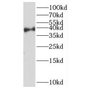 WB analysis of A549 cells, using HOXD13 antibody (1/300 dilution).