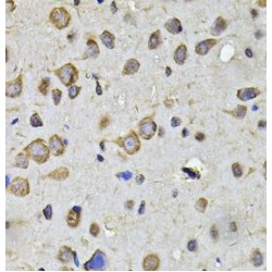 15-Hydroxyprostaglandin Dehydrogenase [NAD(+)] (HPGD) Antibody