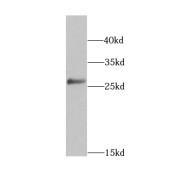 WB analysis of human placenta tissue, using HPGD antibody (1/1000 dilution).