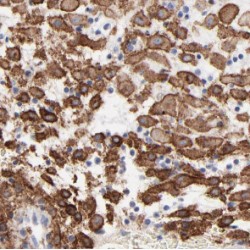 Hematopoietic Prostaglandin D Synthase (HPGDS) Antibody