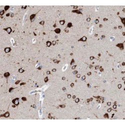 Hypoxanthine Phosphoribosyltransferase 1 (HPRT1) Antibody