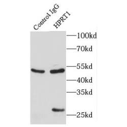 Hypoxanthine Phosphoribosyltransferase 1 (HPRT1) Antibody