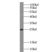 WB analysis of HepG2 cells, using HPRT1 antibody (1/2000 dilution).