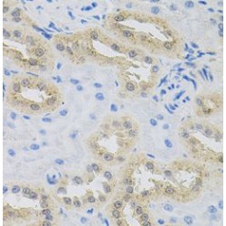 Hermansky-Pudlak Syndrome 1 Protein (HPS1) Antibody