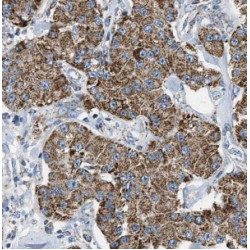 Hermansky-Pudlak Syndrome 3 Protein (HPS3) Antibody