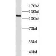 WB analysis of HeLa cells, using HPS3 antibody (1/300 dilution).