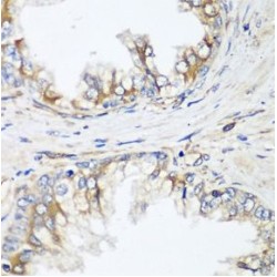 Inactive Heparanase 2 (HPSE2) Antibody