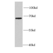 WB analysis of mouse liver tissue, using HPSE2 antibody (1/1000 dilution).