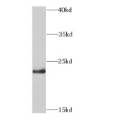 WB analysis of HEK-293 cells, using HRAS-Specific antibody (1/300 dilution).