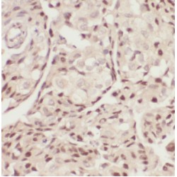 Parafibromin (CDC73) Antibody