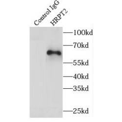 Parafibromin (CDC73) Antibody