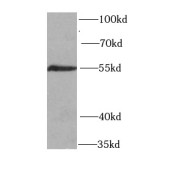 WB analysis of HT-1080 cells, using HS1BP3 antibody (1/1000 dilution).