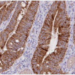 Iron-Sulfur Cluster Co-Chaperone Protein HscB, Mitochondrial (HSCB) Antibody